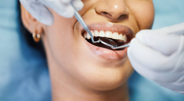 Best Emergency Treatment for Oral Infections in Beverly Hills, TX